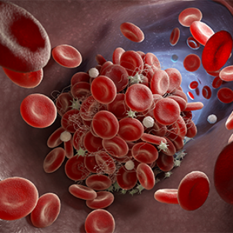 TREM-1 – platelets – endothelium – cardio-metabolic syndrome